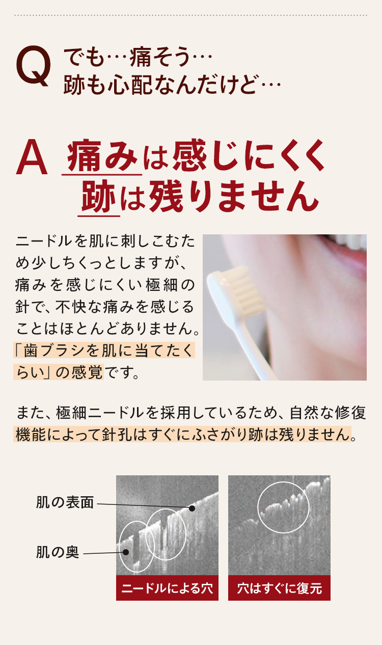 でも痛そう…跡も心配なんだけど…